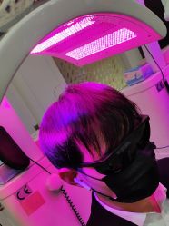 体验后-雍禾植发全国连锁