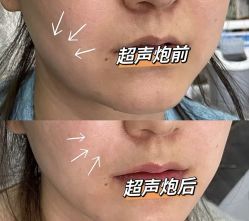 点击看大图 -彼家美创·量肤定制修护管理