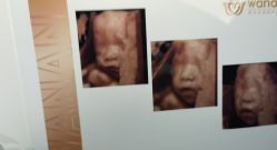 -郑州万安妇产医院