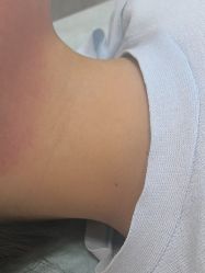 -安徽合肥韩美整形外科医院