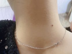 -痣清宫祛斑祛痣连锁店