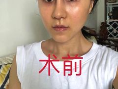 -上海仁爱医院
