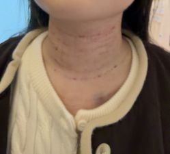 -Yestar杭州艺星医疗美容医院