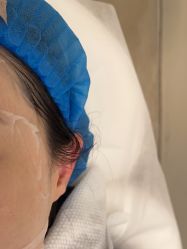 体验后-BR光电保养