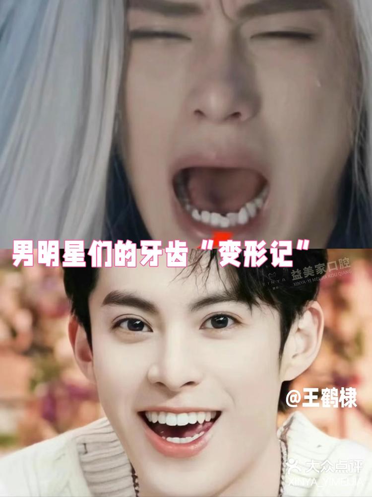 11:24 关注 男明星精致笑容背后的秘密|男士美牙 #男明星们的牙齿07