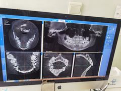 -Dr.Z dental仁康种植矫正中心