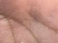 -新甲连锁灰指甲·甲沟炎·鸡眼(黑龙江路店)