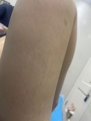 点击看大图 体验前-杭州奥拉克医疗美容门诊部