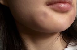 -海涛医疗美容·面部抗衰·注射美鼻