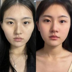 -Yestar 嘉兴艺星医疗美容医院