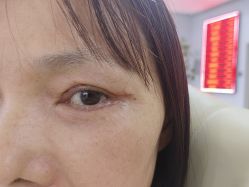 -广州美莱医疗美容医院