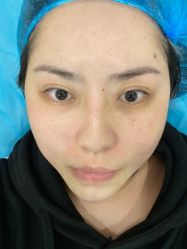 体验后-上海时光整形外科医院