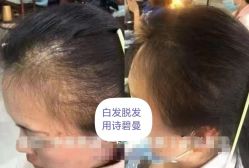 -诗碧曼养发