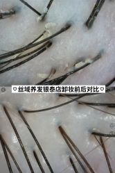 -丝域养发馆