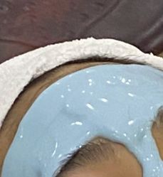 体验后-痘庄科学祛痘国际连锁