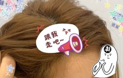 -大麦微针植发全国连锁