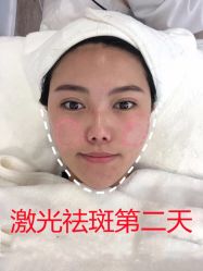 -长沙雅美医疗美容医院