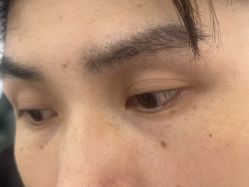 -长沙雅美医疗美容医院