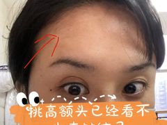 -重庆医科大学附属第一医院(本部)