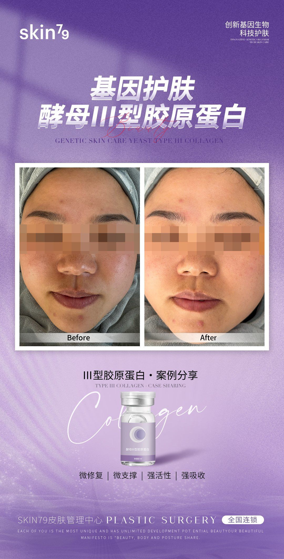 神仙品项酵母三型胶原蛋白