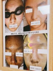 -美肤盾祛痘·问题肌头疗管理中心