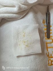-蕾特恩专业祛痘·皮肤管理