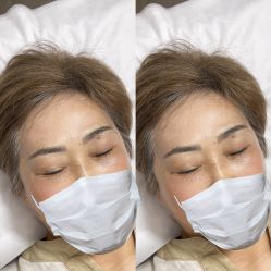 点击看大图 -杨益美学·野生眉半永久纹眉发际线