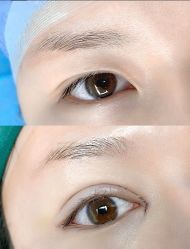 -西安伊美尔医疗美容医院