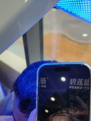 -碧莲盛·不剃发植发