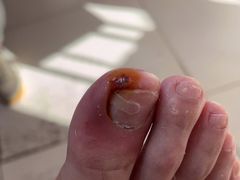 -新甲连锁灰指甲·甲沟炎·鸡眼(黑龙江路店)