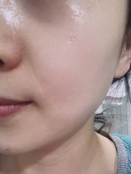 体验后-北京米扬丽格医疗美容·联合丽格鼻整形中心