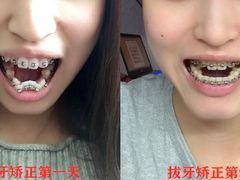 -团圆口腔·种植中心(锦江院区)