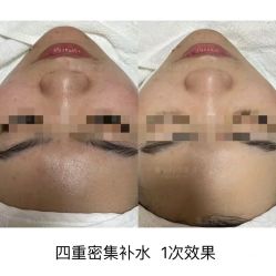 -SKIN79皮肤管理中心