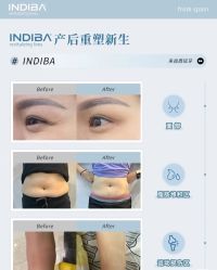 -半岛故事·法儿曼抗衰·indiba中心