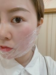 体验前-安徽合肥韩美整形外科医院