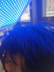 -碧莲盛·不剃发植发