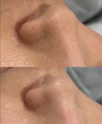 -SKIN79皮肤管理中心