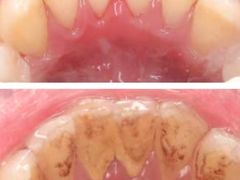 -牙易美口腔(圣堂店)