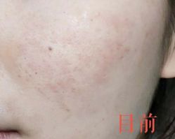 -晶禾臻语·问题肌研究所