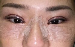 点击看大图 体验后-天津伊美尔医疗整形美容专科医院
