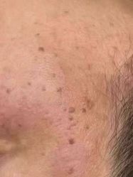 -SKINLALA美肤疗愈SPA