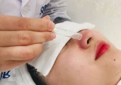 -SOR索尔祛痘·面部肌肤科学管理
