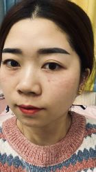 体验后-加减美医美连锁品牌