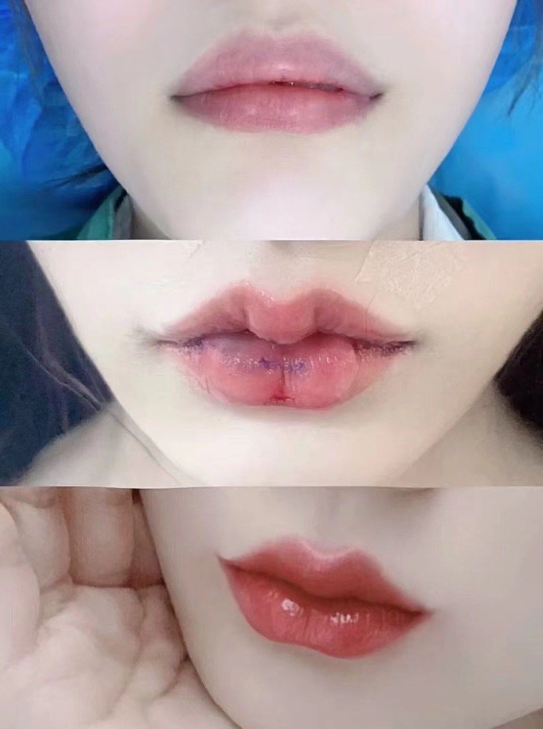 我要变美变好看 
#同城好店推荐
m唇➕嘟嘟唇 
完美唇型➕