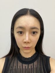 -北京画美医疗美容医院