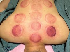 -阮氏中医推拿·颈肩腰腿(世纪公园店)