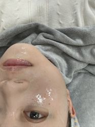 体验后-禾丽康美医疗美容医院