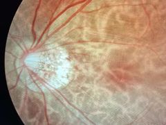 -宝岛眼镜(昆山前进店)