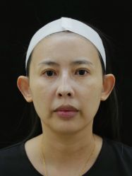 点击看大图 -Yestar重庆艺星医疗美容医院