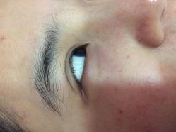 -晶奕空间专业脱毛连锁机构